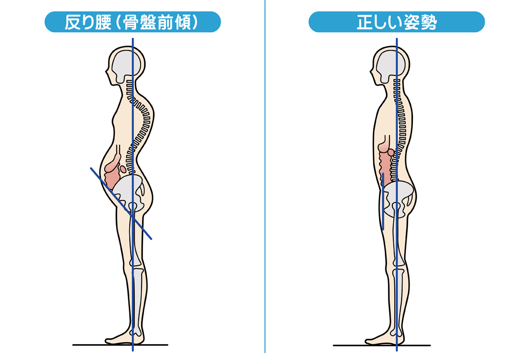 抱っこ紐 トップ 腰骨痛い